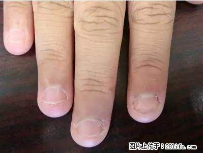 剪指甲、挖耳屎，这些日常小动作竟隐藏大危害！ - 郑州生活资讯 - 郑州28生活网 zz.28life.com